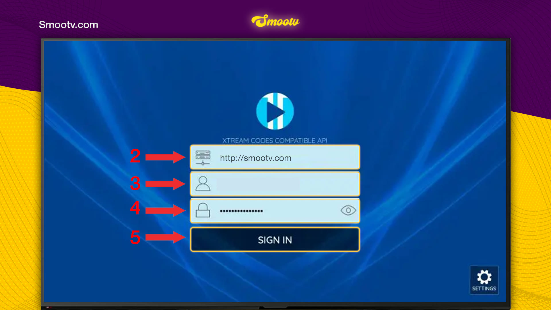 XCIPTV sign-in screen with the server URL, username and password fields and the Sign In button